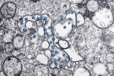 Coronavirus under microscope